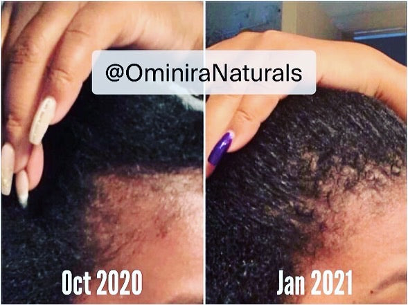 Follicle Fuel – Growth Potion