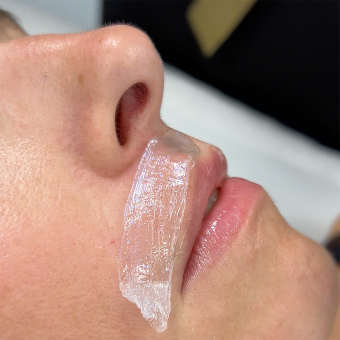 W501 Italwax Snowy Day Film Wax | Close-up of a person's nose with a transparent strip of Italwax Snowy Day film wax on their upper lip
