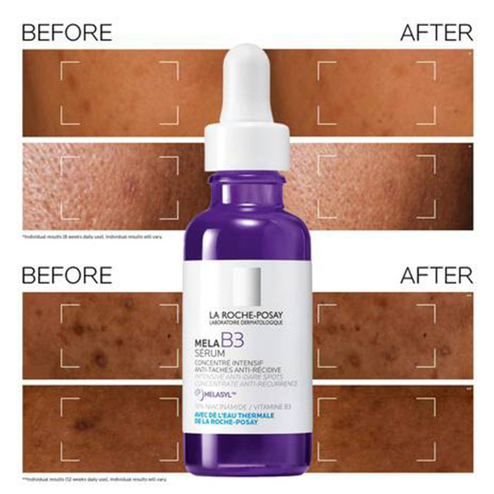 La Roche-Posay Mela B3 Serum 30ml Bottle