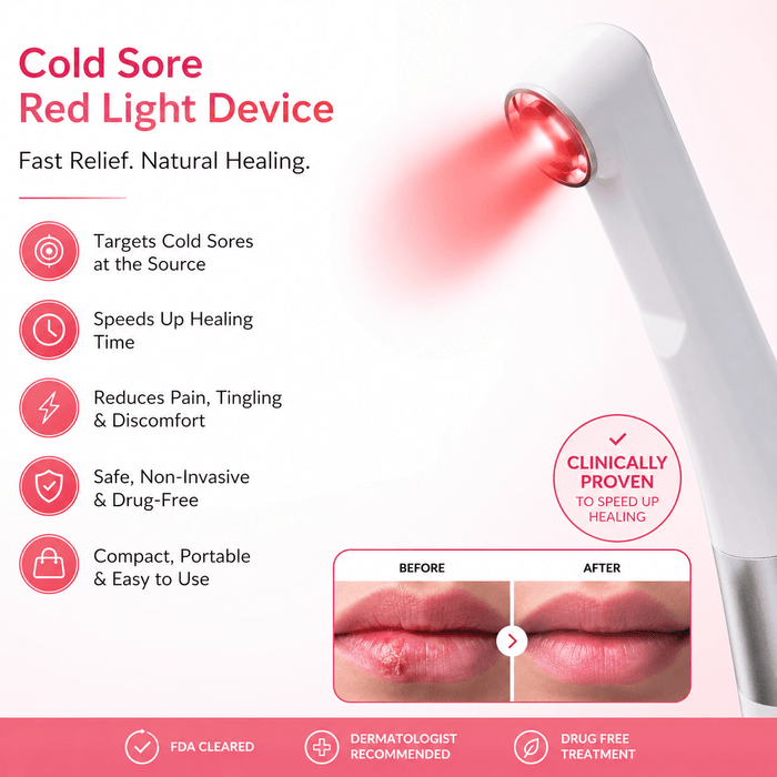 Cold sore red light therapy device for targeted lip care