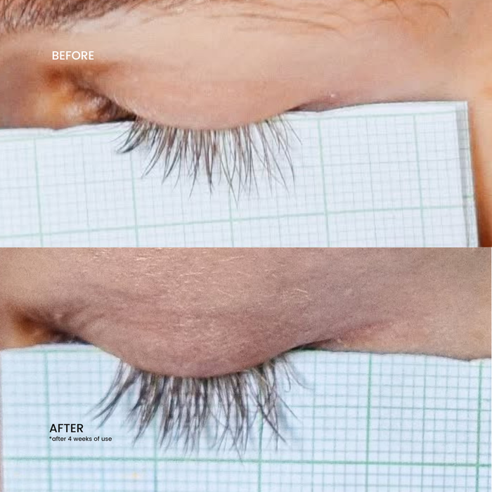 Tweezer & Serum