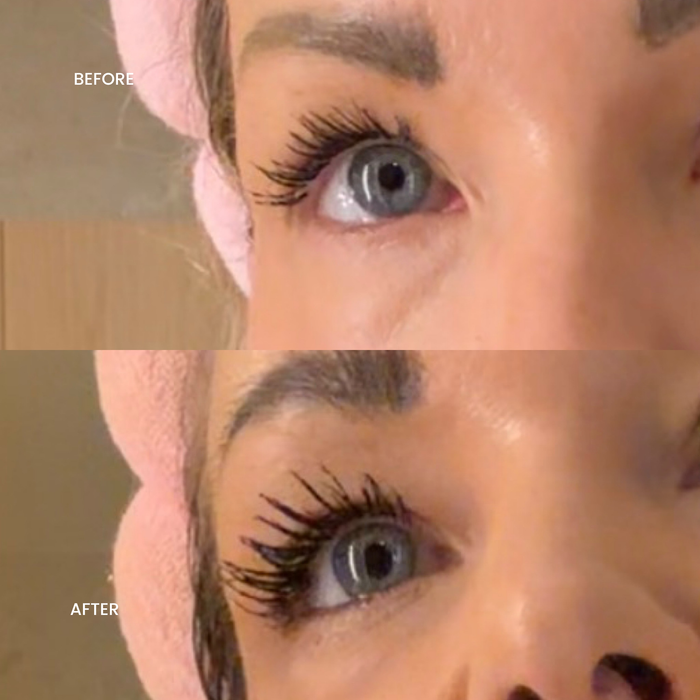 Tweezer & Serum