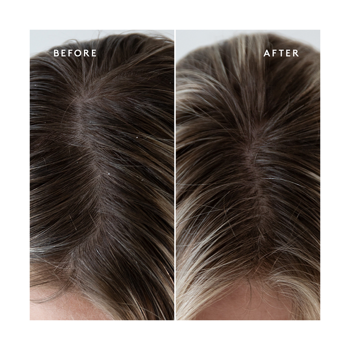 Virtue Refresh Exfoliating Scalp Treatment 150ml